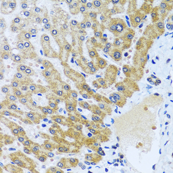 Immunohistochemistry of paraffin-embedded Human liver using CPA6 Polyclonal Antibody at dilution of  1:100 (40x lens).