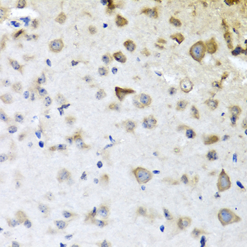 Immunohistochemistry of paraffin-embedded Mouse brain using CPA6 Polyclonal Antibody at dilution of  1:100 (40x lens).