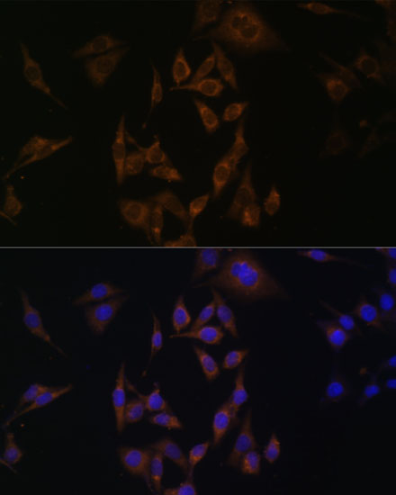 Immunofluorescence analysis of HeLa cells using UBE2L6 Polyclonal Antibody at dilution of  1:100. Blue: DAPI for nuclear staining.