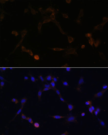 Immunofluorescence analysis of NIH/3T3 cells using UBE2L6 Polyclonal Antibody at dilution of  1:100. Blue: DAPI for nuclear staining.