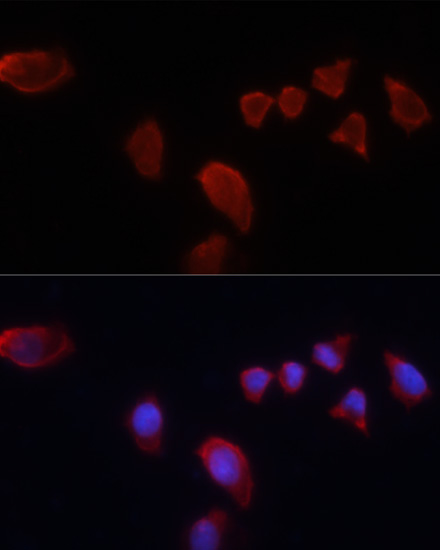 Immunofluorescence analysis of HeLa cells using CA9 Polyclonal Antibody at dilution of  1:100. Blue: DAPI for nuclear staining.