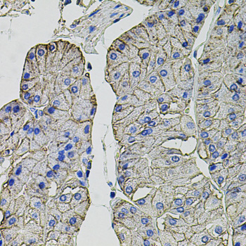 Immunohistochemistry of paraffin-embedded Human stomach using CA9 Polyclonal Antibody at dilution of  1:100 (40x lens).