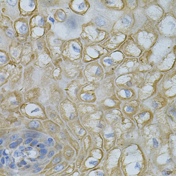 Immunohistochemistry of paraffin-embedded Human esophagus using DEFB132 Polyclonal Antibody at dilution of  1:100 (40x lens).