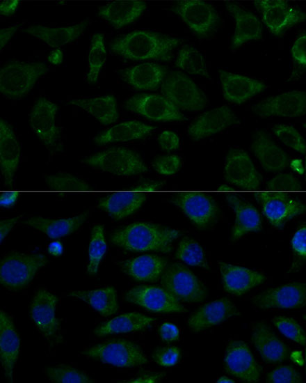 Immunofluorescence analysis of L929 cells using NDUFB7 Polyclonal Antibody at dilution of  1:100 (40x lens). Blue: DAPI for nuclear staining.