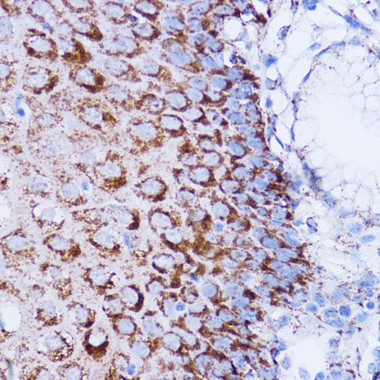 Immunohistochemistry of paraffin-embedded Human esophageal using NDUFB7 Polyclonal Antibody at dilution of  1:100 (40x lens).