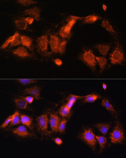 Immunofluorescence analysis of C6 cells using GCSH Polyclonal Antibody at dilution of  1:100 (40x lens). Blue: DAPI for nuclear staining.