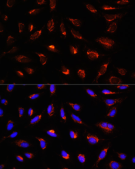 Immunofluorescence analysis of U-2 OS cells using GCSH Polyclonal Antibody at dilution of  1:100 (40x lens). Blue: DAPI for nuclear staining.