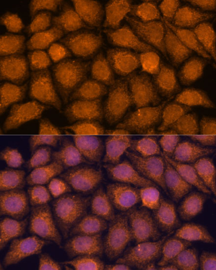 Immunofluorescence analysis of HeLa cells using TNFAIP8L2 Polyclonal Antibody at dilution of  1:100. Blue: DAPI for nuclear staining.