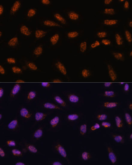 Immunofluorescence analysis of U-2 OS cells using SARNP Polyclonal Antibody at dilution of  1:100. Blue: DAPI for nuclear staining.