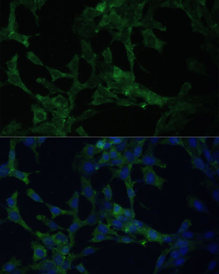 Immunofluorescence analysis of NIH-3T3 cells using CAMLG Polyclonal Antibody at dilution of  1:100 (40x lens). Blue: DAPI for nuclear staining.