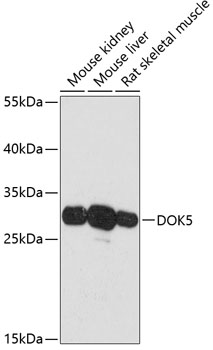 Western blot analysis of extracts of various cell lines using DOK5 Polyclonal Antibody at dilution of 1:3000.