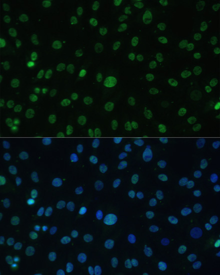 Immunofluorescence analysis of C6 cells using HSF1 Polyclonal Antibody at dilution of  1:100. Blue: DAPI for nuclear staining.