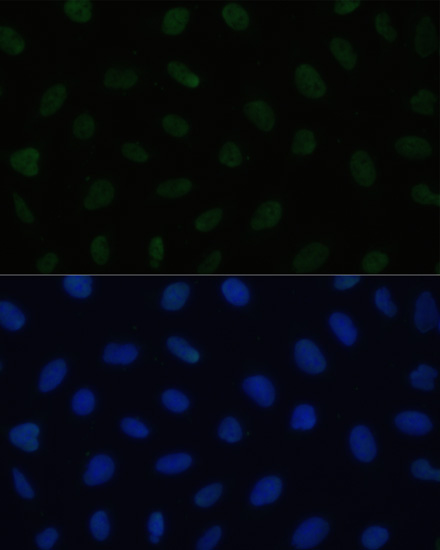 Immunofluorescence analysis of U2OS cells using HSF1 Polyclonal Antibody at dilution of  1:100. Blue: DAPI for nuclear staining.
