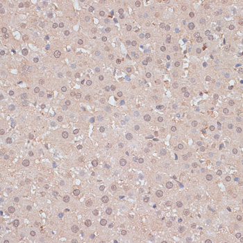 Immunohistochemistry of paraffin-embedded Rat liver using HSF1 Polyclonal Antibody at dilution of  1:100 (40x lens).