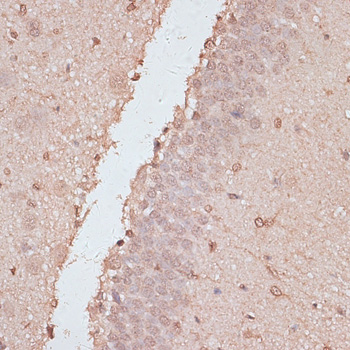 Immunohistochemistry of paraffin-embedded Rat brain using HSF1 Polyclonal Antibody at dilution of  1:100 (40x lens).