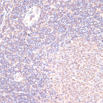 Immunohistochemistry of paraffin-embedded Rat spleen using HSF1 Polyclonal Antibody at dilution of  1:100 (40x lens).