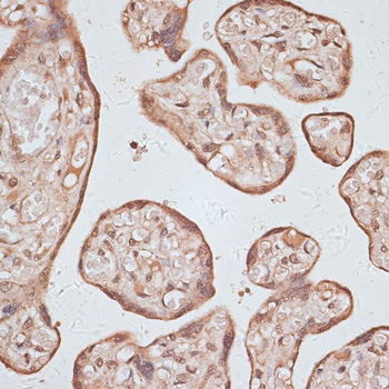 Immunohistochemistry of paraffin-embedded Human placenta using HSF1 Polyclonal Antibody at dilution of  1:100 (40x lens).