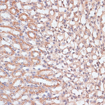 Immunohistochemistry of paraffin-embedded Mouse kidney using HSF1 Polyclonal Antibody at dilution of  1:100 (40x lens).