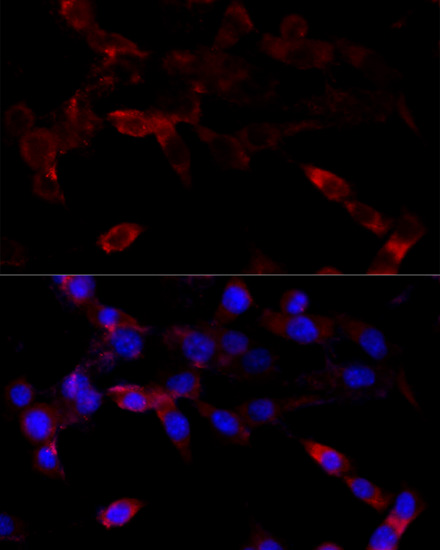 Immunofluorescence analysis of NIH/3T3 cells using CYP1B1 Polyclonal Antibody at dilution of  1:100 (40x lens). Blue: DAPI for nuclear staining.