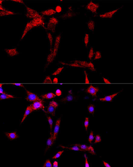 Immunofluorescence analysis of PC-12 cells using CYP1B1 Polyclonal Antibody at dilution of  1:100 (40x lens). Blue: DAPI for nuclear staining.