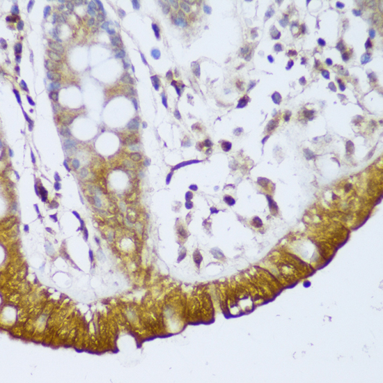 Immunohistochemistry of paraffin-embedded Human colon using GCC2 Polyclonal Antibody at dilution of  1:150 (40x lens).