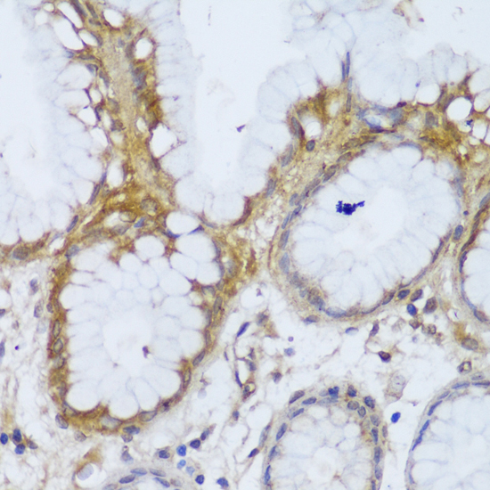 Immunohistochemistry of paraffin-embedded Human stomach using GCC2 Polyclonal Antibody at dilution of  1:150 (40x lens).