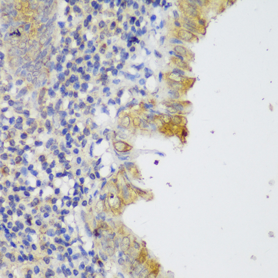 Immunohistochemistry of paraffin-embedded Human appendix using GCC2 Polyclonal Antibody at dilution of  1:150 (40x lens).