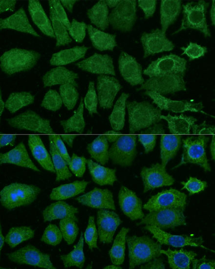 Immunofluorescence analysis of L929 cells using NDUFB4 Polyclonal Antibody at dilution of  1:100 (40x lens). Blue: DAPI for nuclear staining.