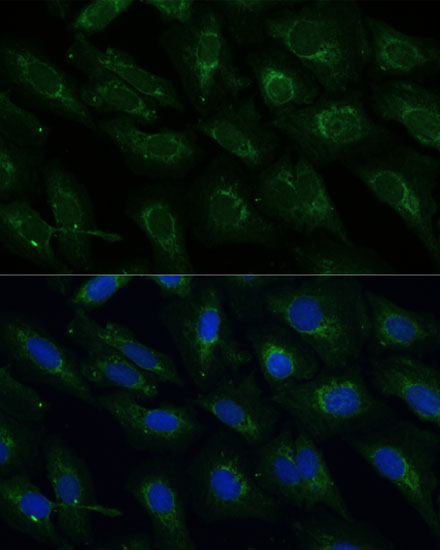 Immunofluorescence analysis of U-2 OS cells using NDUFB4 Polyclonal Antibody at dilution of  1:100 (40x lens). Blue: DAPI for nuclear staining.