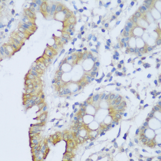 Immunohistochemistry of paraffin-embedded Human colon using CRACR2A Polyclonal Antibody at dilution of  1:150 (40x lens).