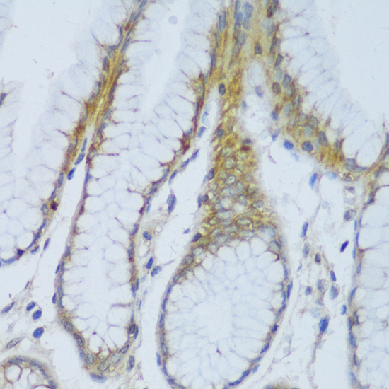 Immunohistochemistry of paraffin-embedded Human stomach using CRACR2A Polyclonal Antibody at dilution of  1:150 (40x lens).