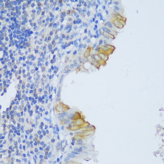 Immunohistochemistry of paraffin-embedded Human appendix using CRACR2A Polyclonal Antibody at dilution of  1:150 (40x lens).