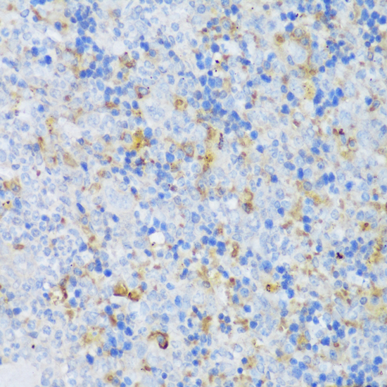 Immunohistochemistry of paraffin-embedded Mouse spleen using CRACR2A Polyclonal Antibody at dilution of  1:150 (40x lens).