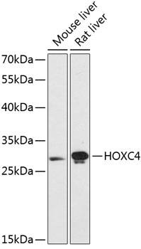 Western blot analysis of extracts of various cell lines using HOXC4 Polyclonal Antibody at dilution of 1:3000.