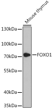 Western blot analysis of extracts of Mouse thymus using FOXO1 Polyclonal Antibody at dilution of 1:3000.