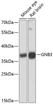 Western blot analysis of extracts of various cell lines using GNB3 Polyclonal Antibody at dilution of 1:1000.