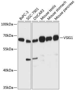 Western blot analysis of extracts of various cell lines using VSIG1 Polyclonal Antibody at dilution of 1:3000.