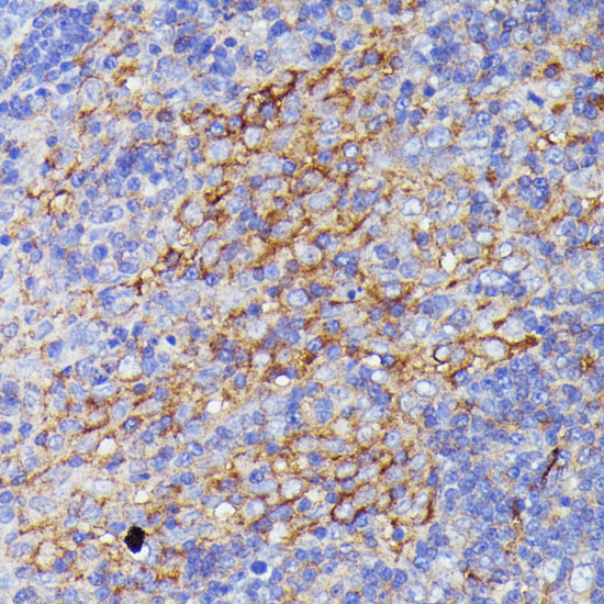 Immunohistochemistry of paraffin-embedded Rat lymph node using SNAP23 Polyclonal Antibody at dilution of  1:100 (40x lens).