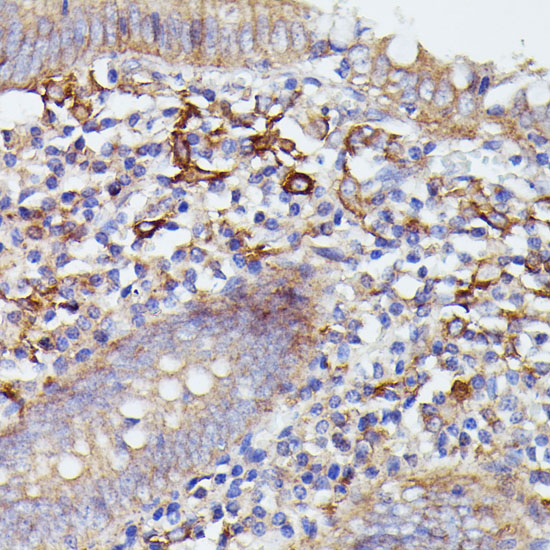 Immunohistochemistry of paraffin-embedded Human appendix using SNAP23 Polyclonal Antibody at dilution of  1:100 (40x lens).