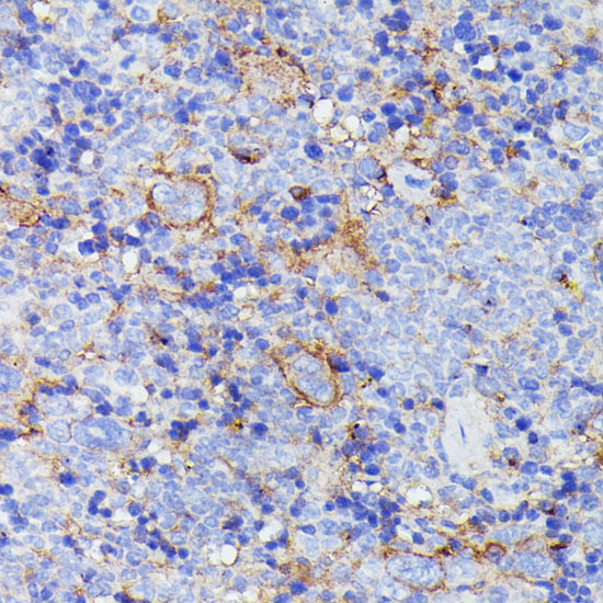 Immunohistochemistry of paraffin-embedded Mouse spleen using SNAP23 Polyclonal Antibody at dilution of  1:100 (40x lens).