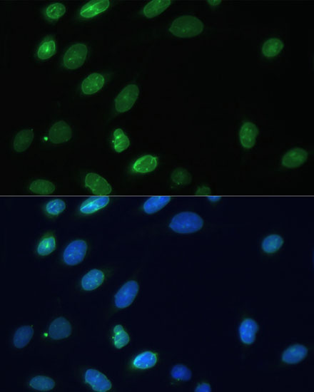 Immunofluorescence analysis of U-2 OS cells using EMD Polyclonal Antibody at dilution of  1:100. Blue: DAPI for nuclear staining.