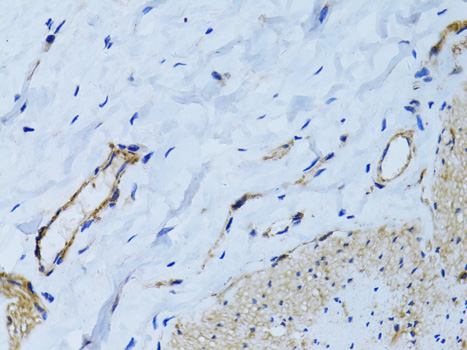 Immunohistochemistry of paraffin-embedded Human colon using MCAM Polyclonal Antibody at dilution of  1:100 (40x lens).