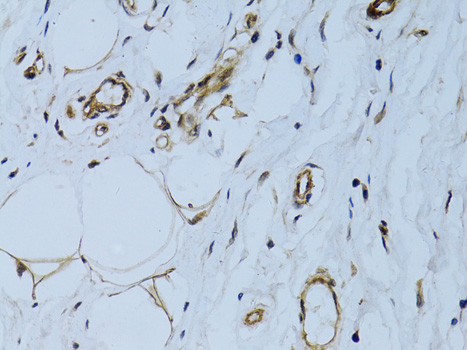 Immunohistochemistry of paraffin-embedded Human breast using MCAM Polyclonal Antibody at dilution of  1:100 (40x lens).