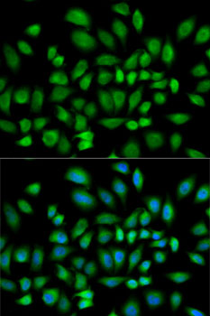 Immunofluorescence analysis of HeLa cells using PDE4D Polyclonal Antibody