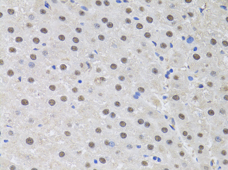 Immunohistochemistry of paraffin-embedded Rat liver using HUS1 Polyclonal Antibody at dilution of  1:100 (40x lens).