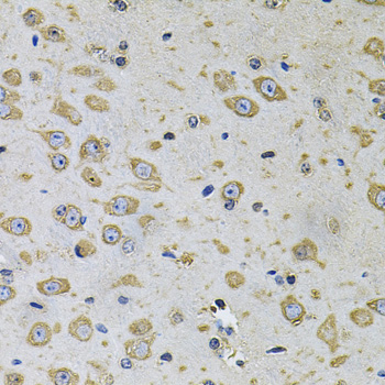 Immunohistochemistry of paraffin-embedded Rat brain using RhoA Polyclonal Antibody at dilution of  1:100 (40x lens).