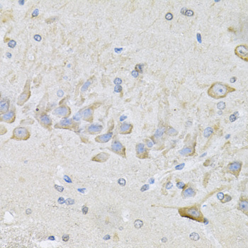 Immunohistochemistry of paraffin-embedded Mouse brain using RhoA Polyclonal Antibody at dilution of  1:100 (40x lens).