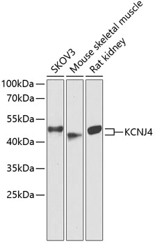 Western blot analysis of extracts of various cell lines using KCNJ4 Polyclonal Antibody at dilution of 1:1000.