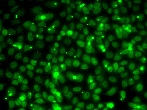 Immunofluorescence analysis of MCF7 cells using RPA3 Polyclonal Antibody