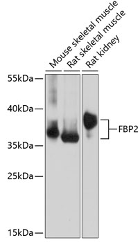 Western blot analysis of extracts of various cell lines using FBP2 Polyclonal Antibody at dilution of 1:1000.